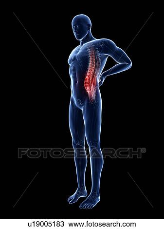 Stock Image - 3d rendered illustration of a man with backache.. Fotosearch