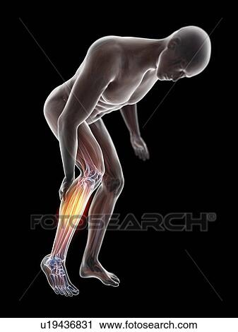 Stock Image - 3d rendered illustration of a man with a painful calf.. Fotosearch