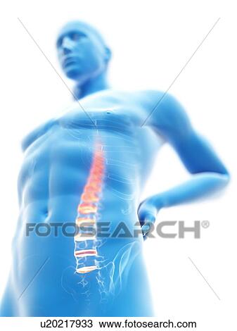 3d rendered illustration of a man with backache. View Large Photo Image Stock Image - 3d rendered illustration of a man with backache.. Fotosearch