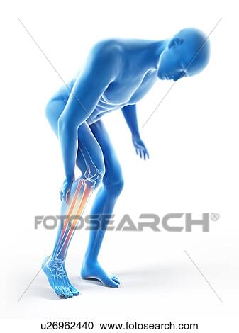 3d rendered illustration of a man with a painful calf. View Large Photo Image Stock Image - 3d rendered illustration of a man with a painful calf.. Fotosearch