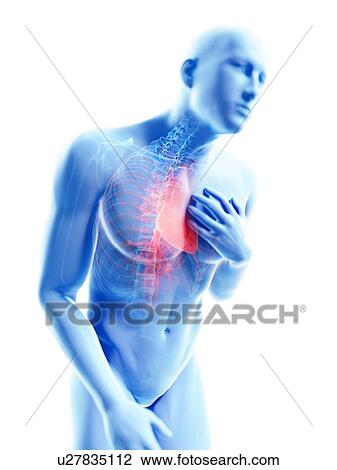 Stock Image - 3d rendered illustration of a man with chest pain.. Fotosearch