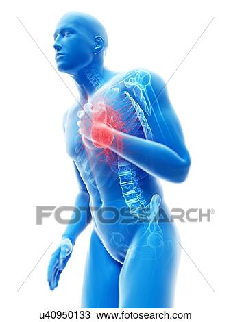 Stock Image - 3d rendered illustration of a man with chest pain.. Fotosearch