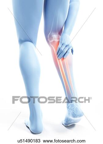 Stock Image - 3d rendered illustration of a man with a painful calf.. Fotosearch
