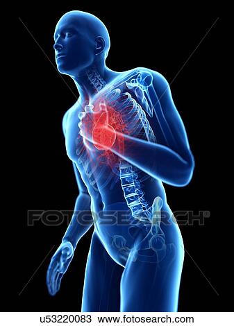 Stock Image - 3d rendered illustration of a man with chest pain.. Fotosearch