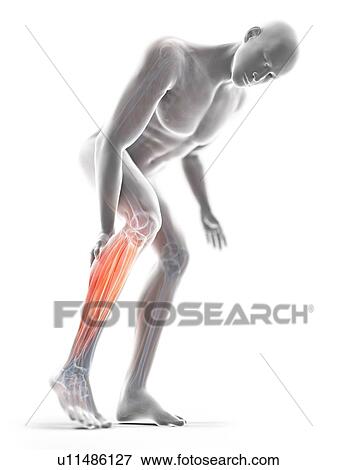 3d rendered illustration of a man with a painful calf. View Large Photo Image Stock Photo - 3d rendered illustration of a man with a painful calf.. Fotosearch