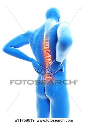 3d rendered illustration of a man with backache. View Large Photo Image Stock Photo - 3d rendered illustration of a man with backache.. Fotosearch