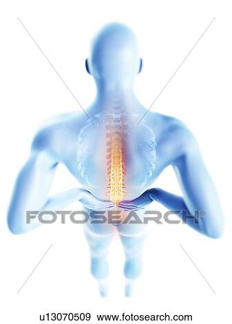 3d rendered illustration of a man with backache. View Large Photo Image Stock Photo - 3d rendered illustration of a man with backache.. Fotosearch