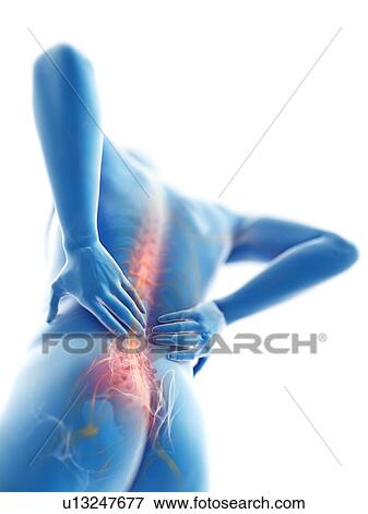 Stock Photo - 3d rendered illustration of a man with backache.. Fotosearch
