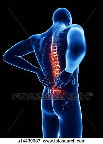 Stock Photo - 3d rendered illustration of a man with backache.. Fotosearch