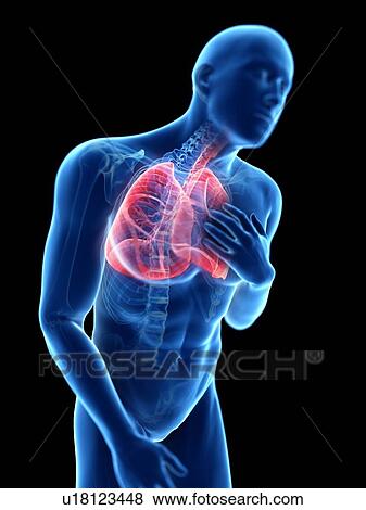 3d rendered illustration of a man with an inflamed lung. View Large Photo Image Stock Photo - 3d rendered illustration of a man with an inflamed lung.. Fotosearch