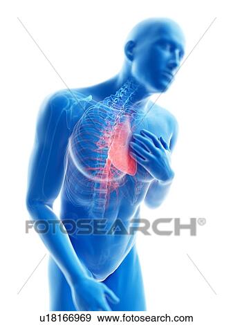 Stock Photo - 3d rendered illustration of a man with chest pain.. Fotosearch