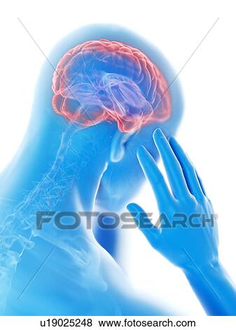 Stock Photo - 3d rendered illustration of a man with a headache.. Fotosearch