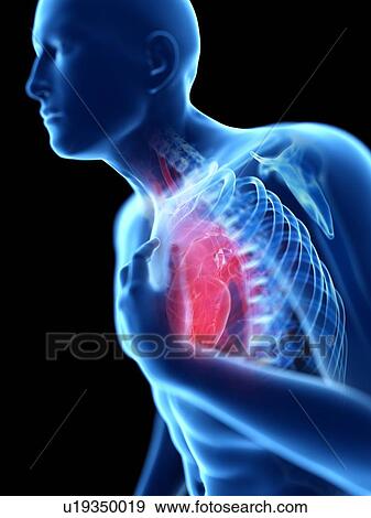 3d rendered illustration of a man with chest pain. View Large Photo Image Stock Photo - 3d rendered illustration of a man with chest pain.. Fotosearch
