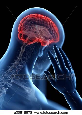 Stock Photo - 3d rendered illustration of a man with a headache.. Fotosearch