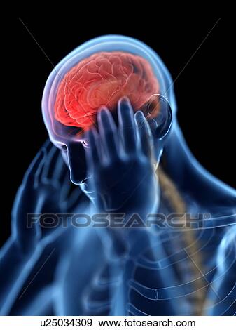 3d rendered illustration of a man with a headache. View Large Photo Image Stock Photo - 3d rendered illustration of a man with a headache.. Fotosearch