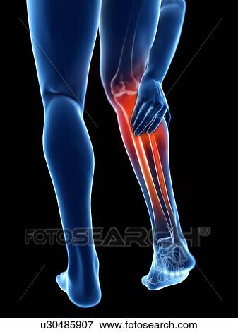 3d rendered illustration of a man with a painful calf. View Large Photo Image Stock Photo - 3d rendered illustration of a man with a painful calf.. Fotosearch