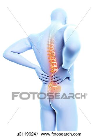Stock Photo - 3d rendered illustration of a man with backache.. Fotosearch
