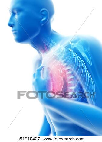 3d rendered illustration of a man with chest pain. View Large Photo Image Stock Photo - 3d rendered illustration of a man with chest pain.. Fotosearch