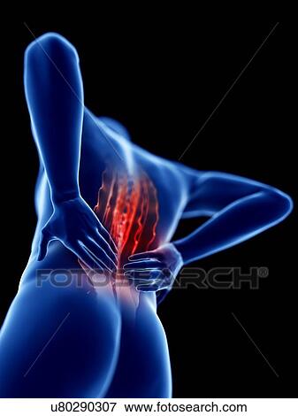 Stock Photo - 3d rendered illustration of a man with backache.. Fotosearch