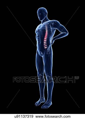 Stock Photo - 3d rendered illustration of a man with backache.. Fotosearch