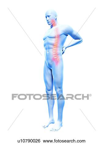 Stock Photograph - 3d rendered illustration of a man with backache.. Fotosearch