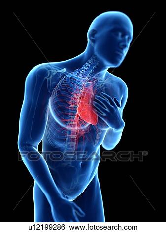 3d rendered illustration of a man with chest pain. View Large Photo Image Stock Photograph - 3d rendered illustration of a man with chest pain.. Fotosearch