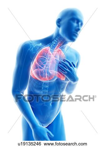 3d rendered illustration of a man with an inflamed lung. View Large Photo Image Stock Photograph - 3d rendered illustration of a man with an inflamed lung.. Fotosearch