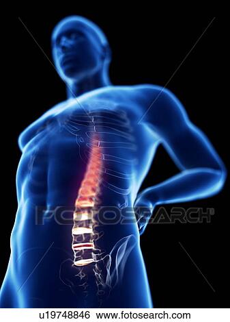 Stock Photograph - 3d rendered illustration of a man with backache.. Fotosearch