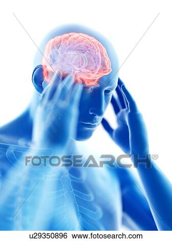 3d rendered illustration of a man with a headache. View Large Photo Image Stock Photograph - 3d rendered illustration of a man with a headache.. Fotosearch