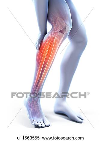 3d rendered illustration of a man with a painful calf. View Large Photo Image Stock Photography - 3d rendered illustration of a man with a painful calf.. Fotosearch