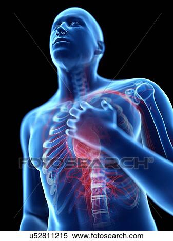 Stock Photography - 3d rendered illustration of a man with chest pain.. Fotosearch