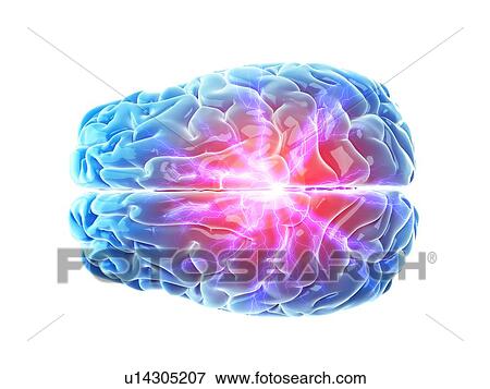 Stock Photo - 3d rendered illustration of a painful brain.. Fotosearch