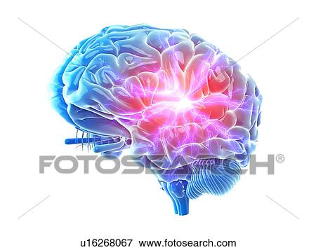 3d rendered illustration of a painful brain. View Large Photo Image Stock Photo - 3d rendered illustration of a painful brain.. Fotosearch
