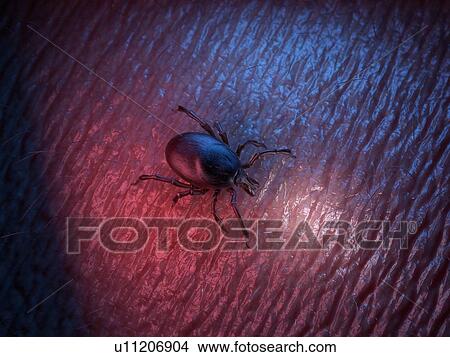 Picture - 3d rendered illustration of a tick on skin.. Fotosearch