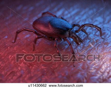 3d rendered illustration of a tick on skin. View Large Photo Image Stock Image - 3d rendered illustration of a tick on skin.. Fotosearch