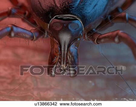 3d rendered illustration of a tick on human skin. View Large Photo Image Stock Image - 3d rendered illustration of a tick on human skin.. Fotosearch