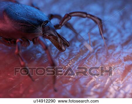 3d rendered illustration of a tick on skin. View Large Photo Image Stock Image - 3d rendered illustration of a tick on skin.. Fotosearch