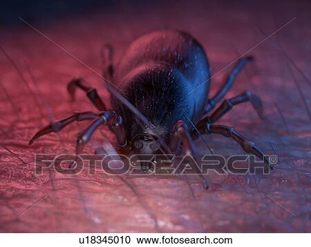 Stock Image - 3d rendered illustration of a tick on skin.. Fotosearch