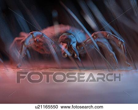 3d rendered illustration of a tick on human skin. View Large Photo Image Stock Image - 3d rendered illustration of a tick on human skin.. Fotosearch