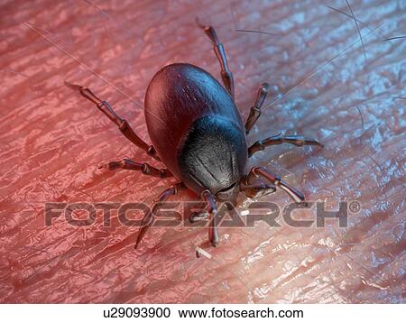 Stock Image - 3d rendered illustration of a tick on human skin.. Fotosearch