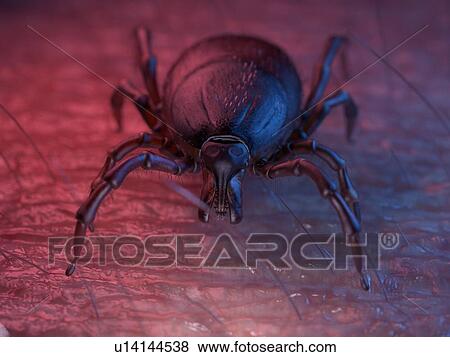 Stock Photo - 3d rendered illustration of a tick on skin.. Fotosearch