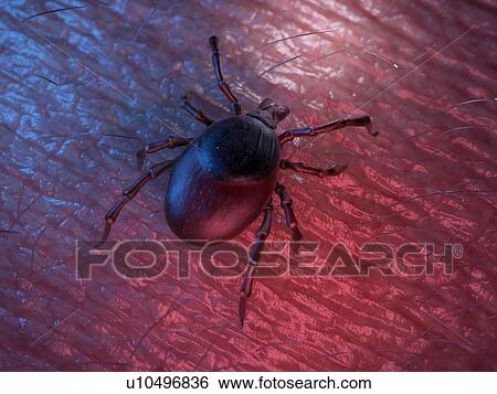 3d rendered illustration of a tick on skin. View Large Photo Image Stock Photograph - 3d rendered illustration of a tick on skin.. Fotosearch