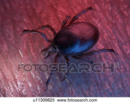 Stock Photography - 3d rendered illustration of a tick on skin.. Fotosearch