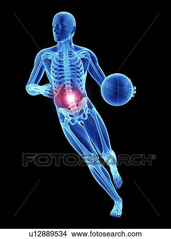 Picture - 3d rendered illustration of an athlete's painful spine.. Fotosearch