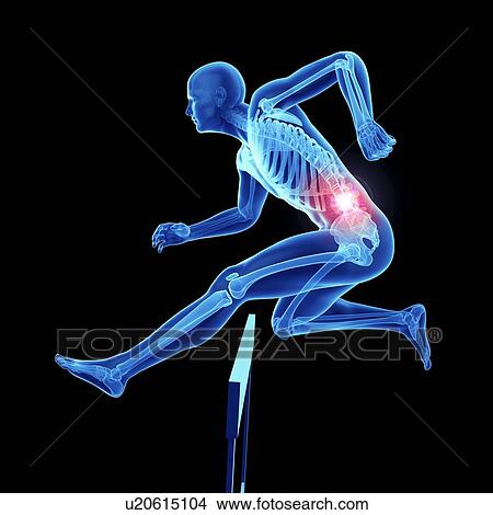 Picture - 3d rendered illustration of an athlete's painful back.. Fotosearch