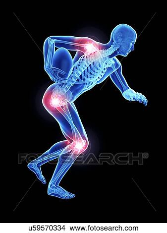 3d rendered illustration of an athlete's painful joints. View Large Photo Image Picture - 3d rendered illustration of an athlete's painful joints.. Fotosearch
