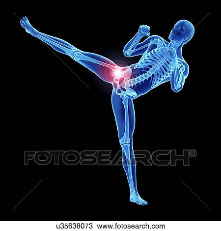 Stock Image - 3d rendered illustration of an athlete's painful hip joint.. Fotosearch