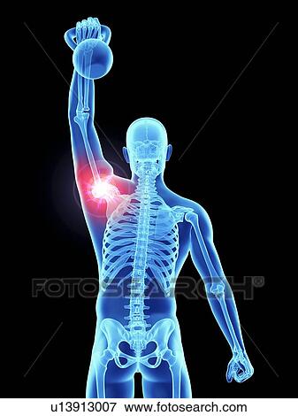 Stock Photo - 3d rendered illustration of an athlete's painful shoulder joint.. Fotosearch