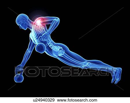 3d rendered illustration of an athlete's painful shoulder joint. View Large Photo Image Stock Photo - 3d rendered illustration of an athlete's painful shoulder joint.. Fotosearch