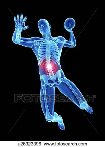Stock Photograph - 3d rendered illustration of an athlete's painful spine.. Fotosearch